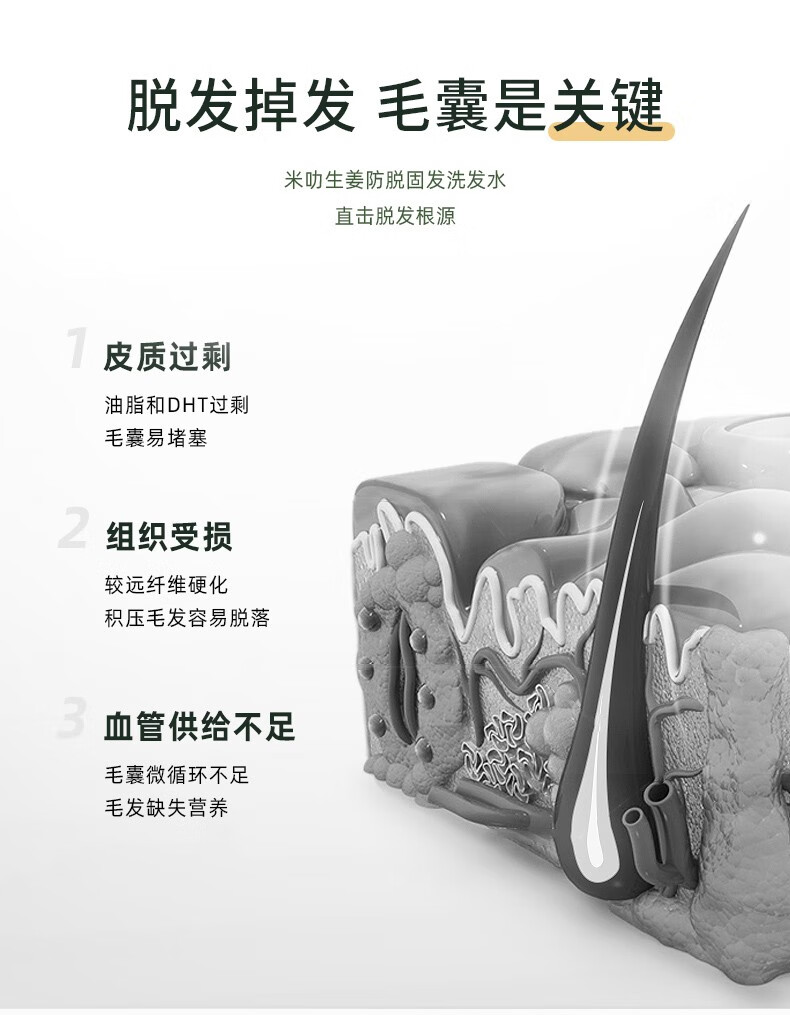 脫發(fā)掉發(fā)毛囊是關(guān)鍵   米叻生姜防脫固發(fā)洗發(fā)水   直擊脫發(fā)根源   皮質(zhì)過剩 油脂和DHT過剩 毛囊易堵塞   組織受損 較遠(yuǎn)纖維硬化 積壓毛發(fā)容易脫落   血管供給不足 毛囊微循環(huán)不足 毛發(fā)缺失營養(yǎng)