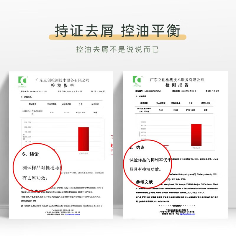 持證去屑，控油平衡，控油去屑不是說說而已